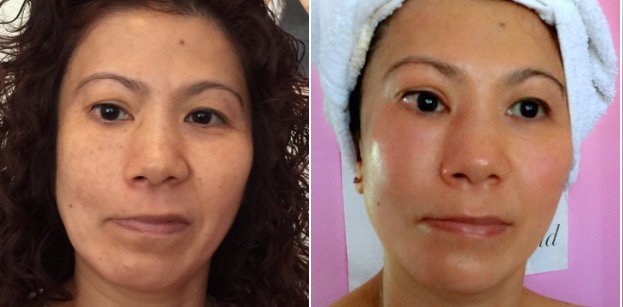 AF-Before-After