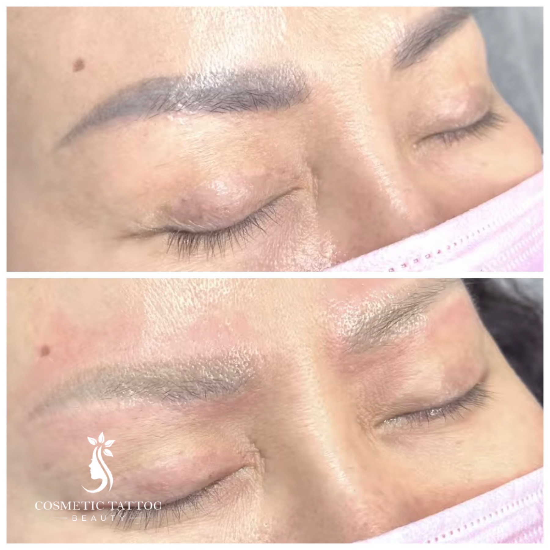 AF-Before-After