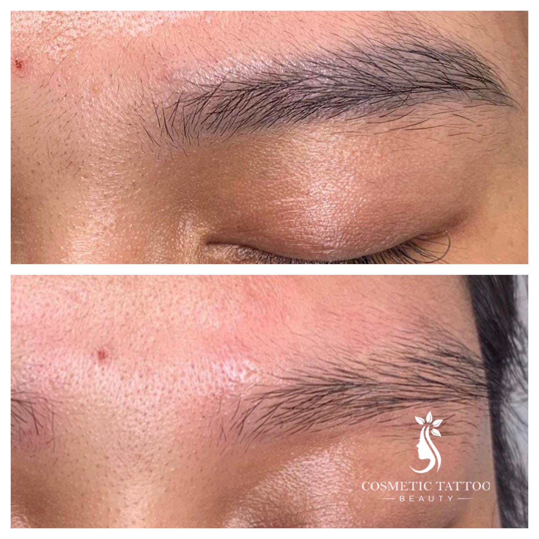 AF-Before-After