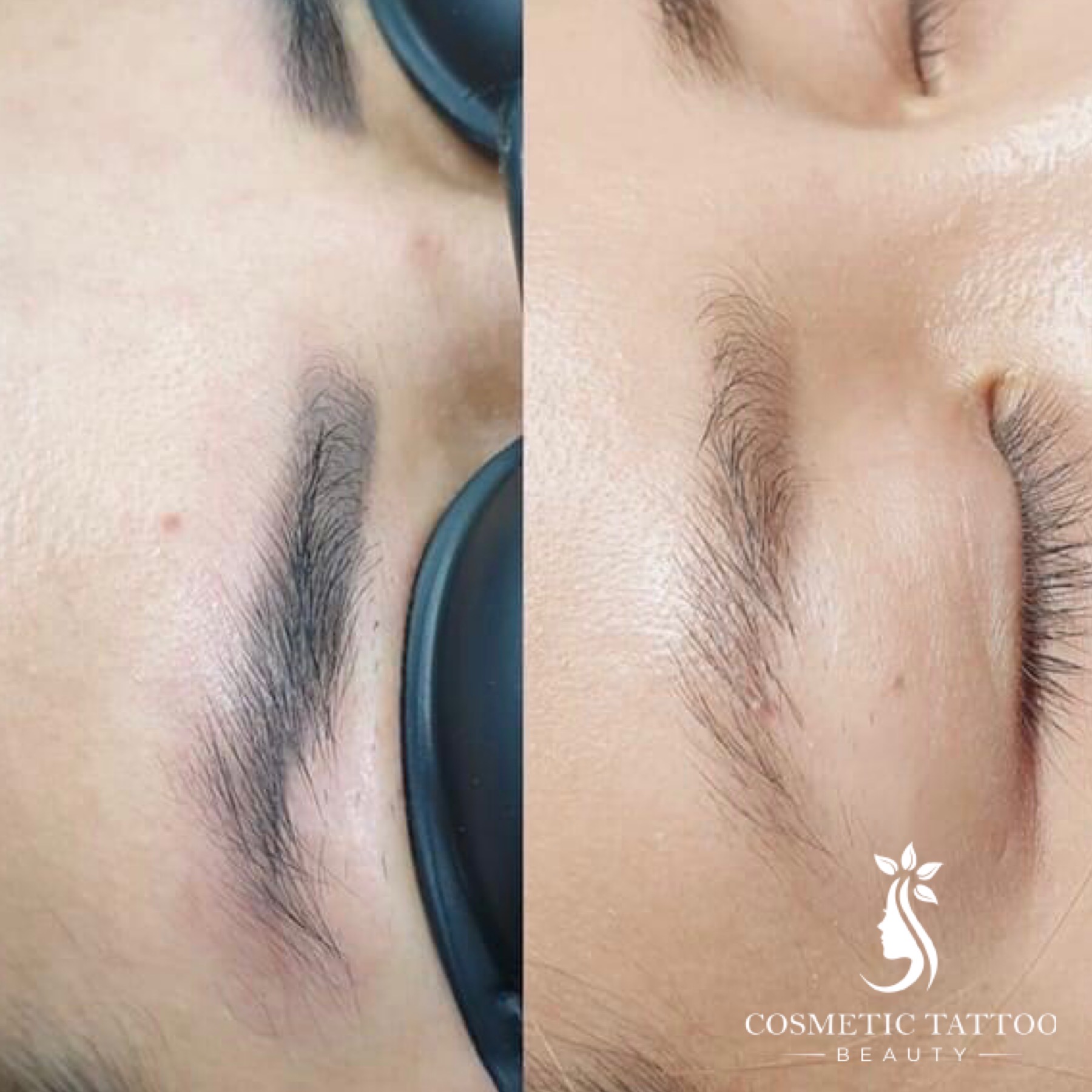 AF-Before-After