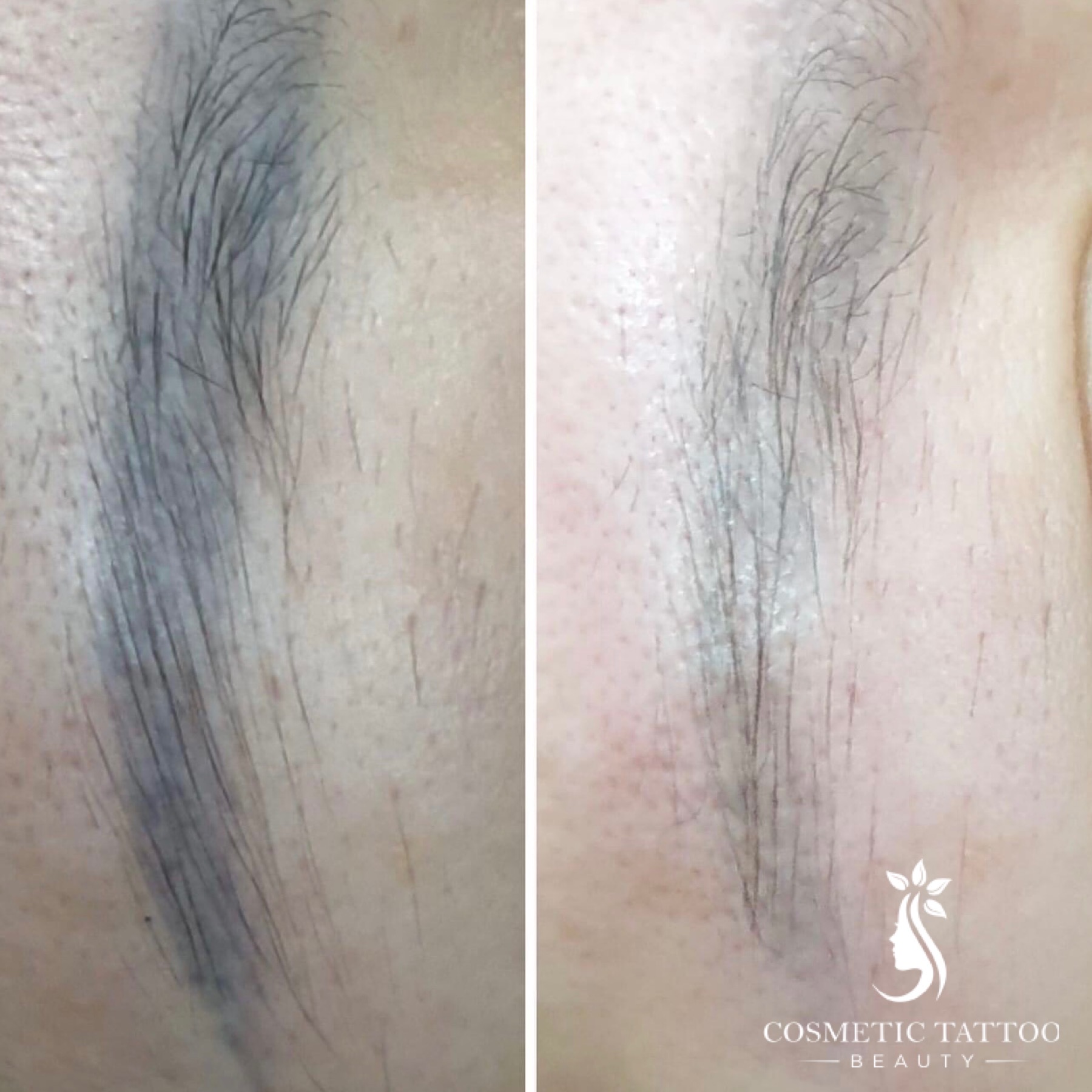 AF-Before-After