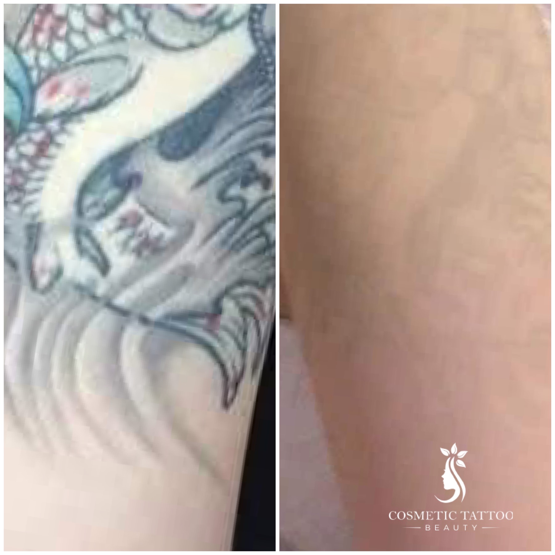 AF-Before-After