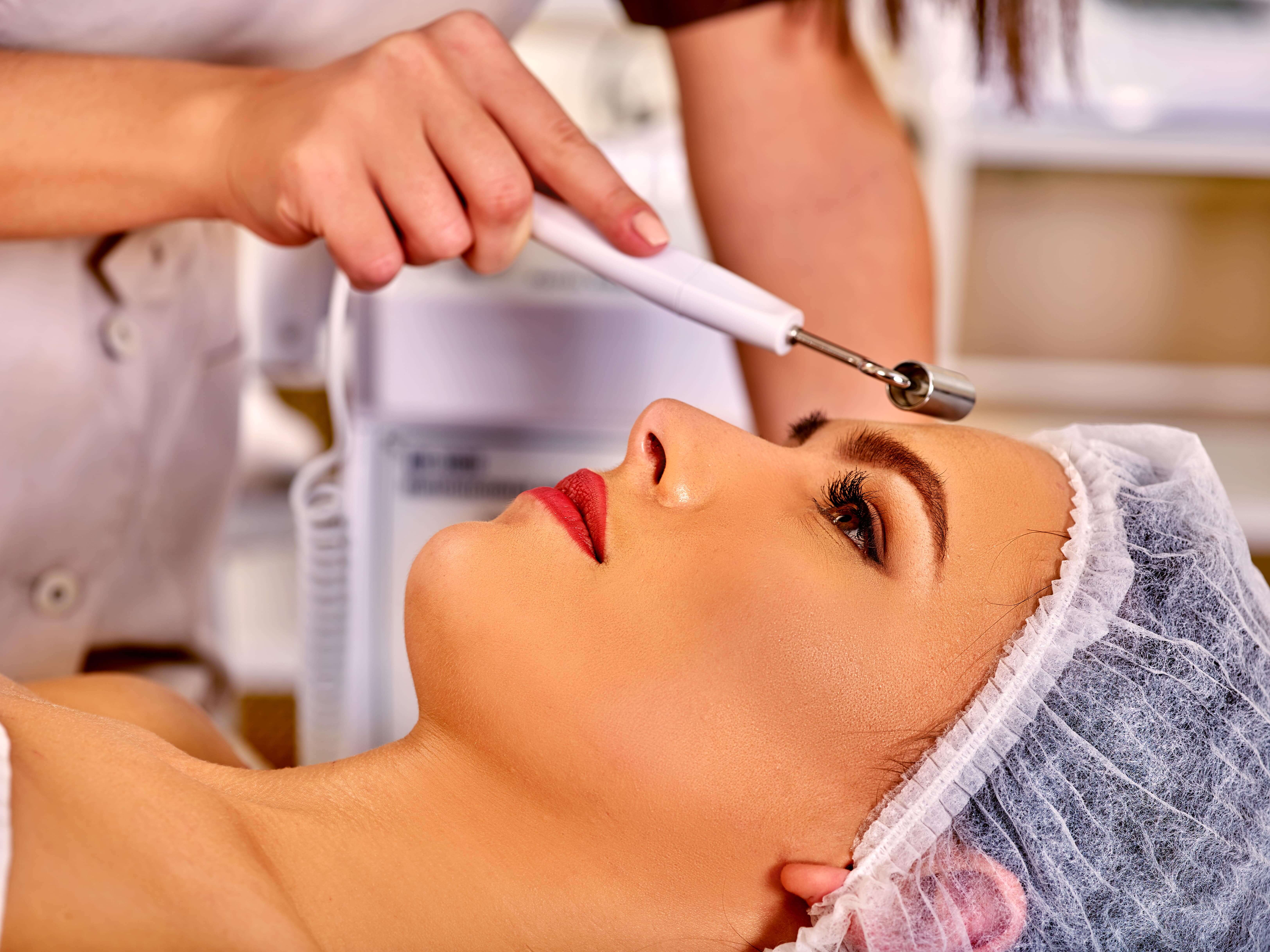 carbon-laser-facial